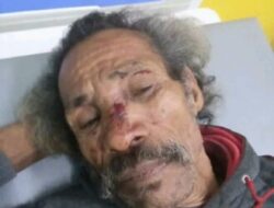 Lansia 72 Tahun di Malaka Barat Dikeroyok Saat Hadiri Rumah Duka, Keluarga Desak Polisi