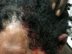 17 Warga Sipil dan Aktivis FNMPP Ditangkap Saat Aksi Tolak Pemindahan Tahanan Politik di Sorong