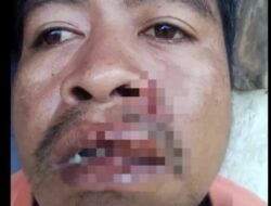 Guru Pingsan Setelah Diduga Dipermalukan Bupati Sikka di Depan Umum